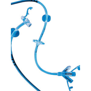 MIC-KEY Low-Profile Transgastric-Jejunal Feeding Tube, 18 Fr, 1.5 cm Stoma Length, 30 cm Jejunal Length