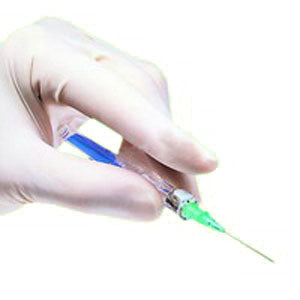 Saf-T-Intima Winged IV Cath System 22G x 3/4" (Box of 25)