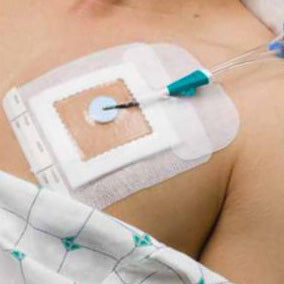 Sorbaview 2000 Window Dressing, 4.5" X 4.5" (Case of 50)