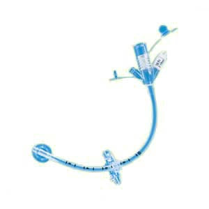 MIC Adult Gastrostomy Feeding Tube 30 fr