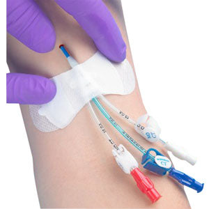 Grip-Lok Securement Device for Universal PICC Catheter, 3-1/2", 1/4" - 1/2" Tubing